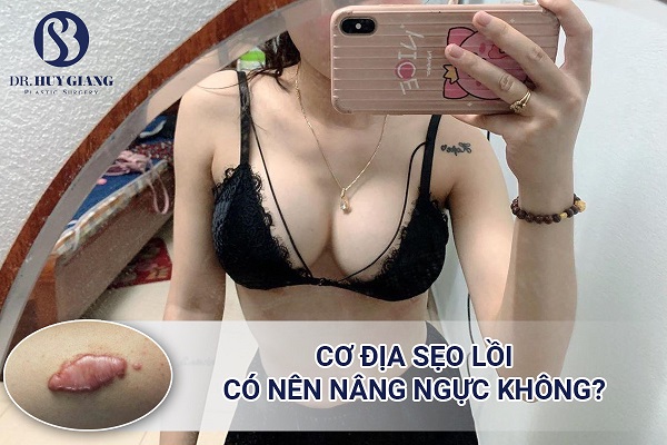 Cơ địa sẹo lồi có nên nâng ngực không? Cách để không bị sẹo lồi