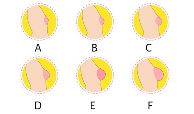 Cup ngực ABC là gì? Cách chọn size phù hợp với từng dáng ngực