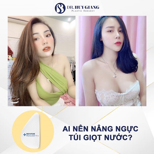 Những ai phù hợp nâng ngực túi giọt lệ