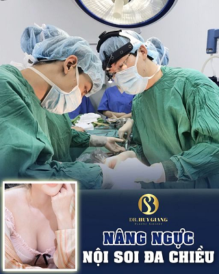Phẫu thuật nâng ngực nội soi đa chiều an toàn 