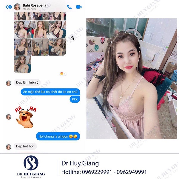 Khách hàng feedback sau nâng ngực mentor xtra tại Dr Huy Giang