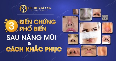 Những hiện tượng sau khi nâng mũi nào là bất thường và bình thường