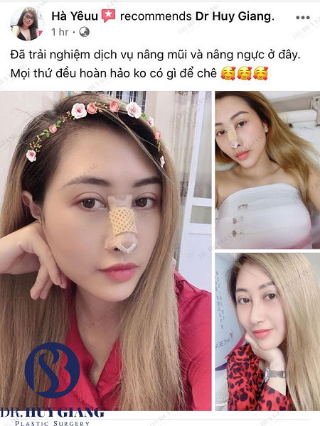 Tại sao nâng mũi tại Dr Huy Giang không để lại sẹo?