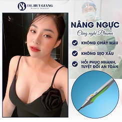 Những điều cần biết về phẫu thuật nâng ngực - Bác sĩ chia sẻ