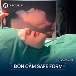 Độn Cằm Giá Bao Nhiêu? Bảng Giá 2025