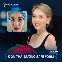 Độn thái dương giá bao nhiêu? Có đắt không?